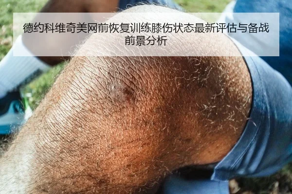 德约科维奇美网前恢复训练膝伤状态最新评估与备战前景分析